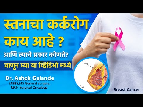 Breast Cancer: Signs, Stages & Treatment Options Explained by Dr. Ashok Galande [Video]