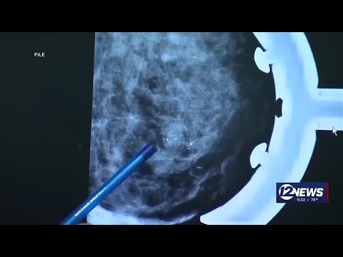 U.S. task force confirms mammograms recommendations [Video]