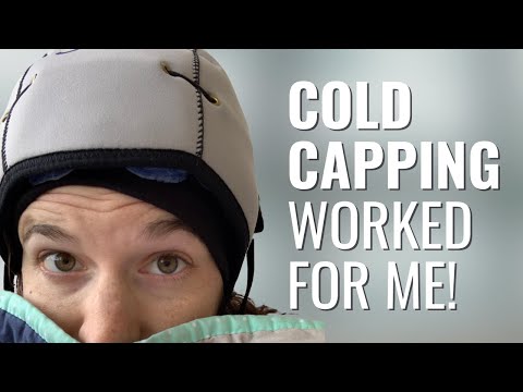 How I Kept My Hair During Chemotherapy  – Alison | Cold Capping | The Patient Story [Video]