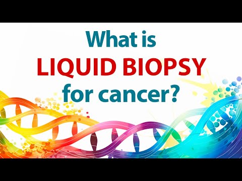 Have You Heard of Liquid Biopsy for Cancer? [Video]