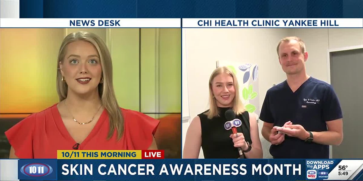 How to protect yourself from sun damage during skin cancer awareness month [Video]
