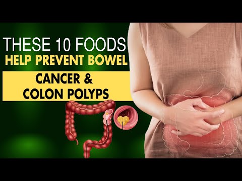 TOP 10 BEST Foods for Colon Cancer Prevention [Video]