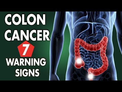 TOP 7 Warning Signs You May Have Colon Cancer [Video]