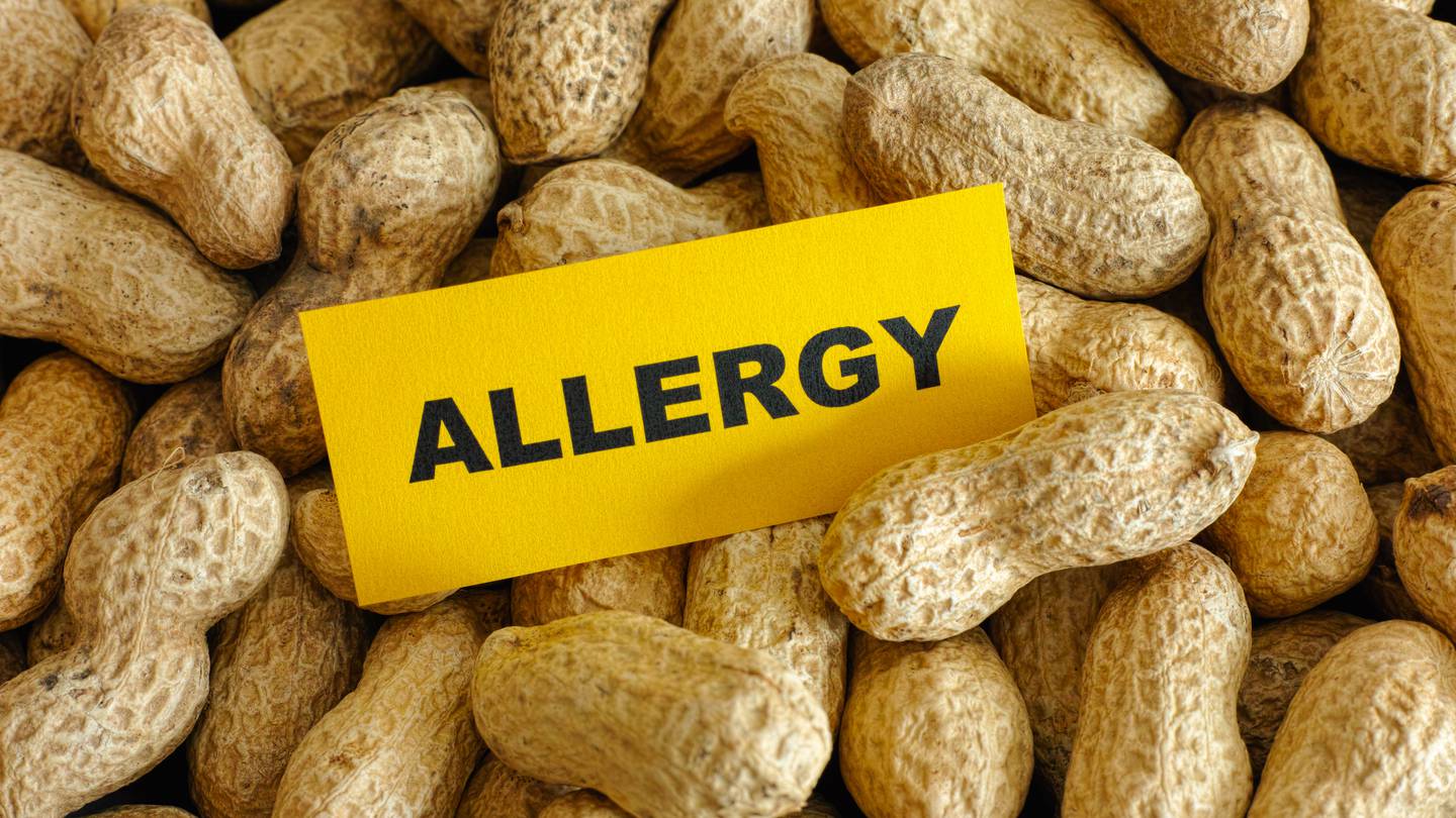 British clinical trial shows hope for patients with peanut, food allergies  WSOC TV [Video]