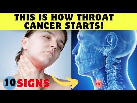 This is How Throat Cancer STARTS and No One Tells You – Symptoms [Video]