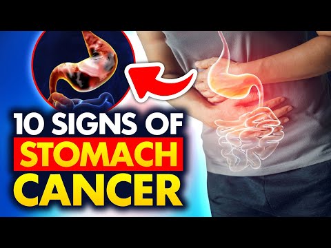 10 Stomach Cancer Symptoms You Really Want to Know! [Video]