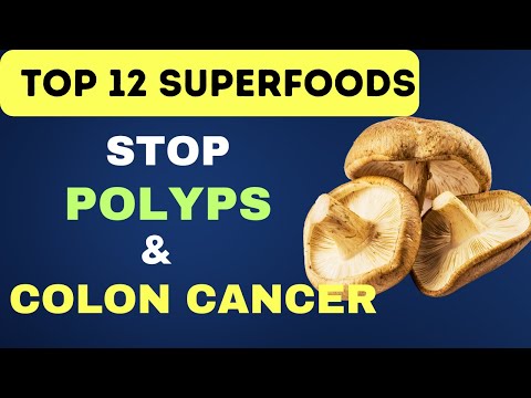 12 Superfoods to Prevent Colon Polyps and Bowel Cancer | Colon Cancer Prevention [Video]
