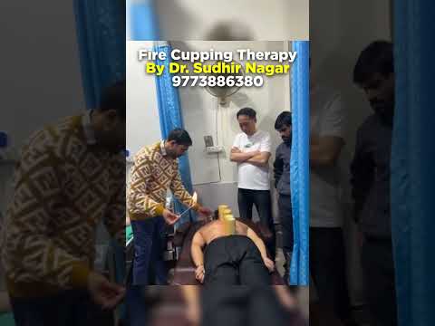 fire cupping therapy by Dr. Sudhir Nagar 9773886380 [Video]