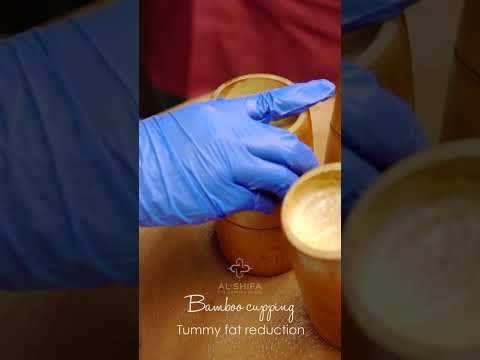 Tummy fat reduction treatment [Video]