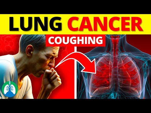 Persistent Cough and Lung Cancer | EXPLAINED ⚠️ [Video]