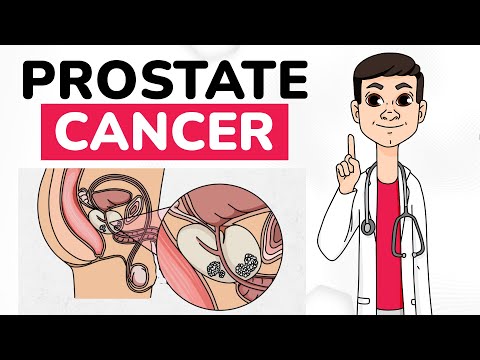 PROSTATE CANCER: Risk factors, Signs and Symptoms, Diagnosis and Treatment | Doctor.Global Explains [Video]