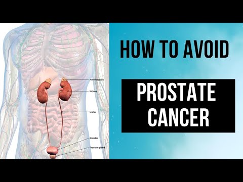 How to Prevent Prostate Cancer: 7 Essential Tips [Video]
