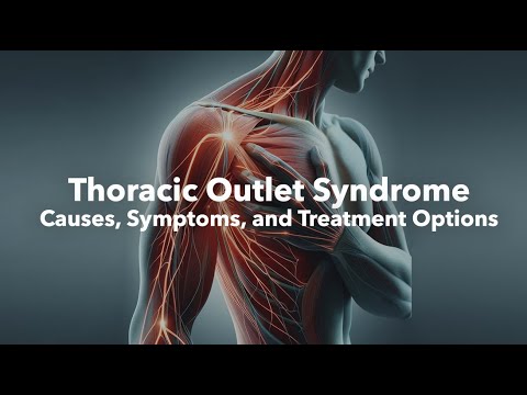 What is Thoracic Outlet Syndrome: Causes, Symptoms, and Treatment Options [Video]