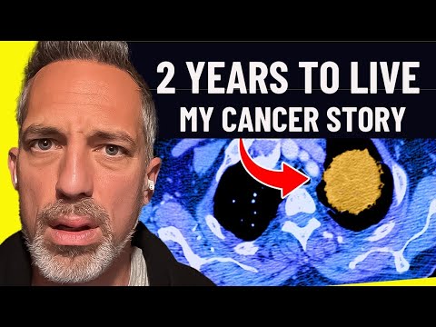 My Full Cancer Diagnosis and Treatment Plan (stage 4 terminal) [Video]