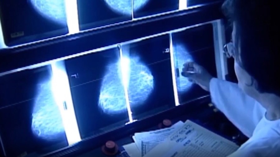 National health panel recommends mammograms start at 40 [Video]