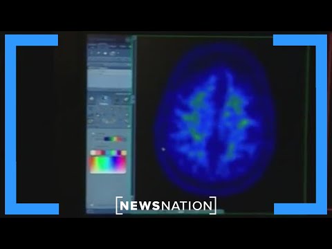 Researchers develop vaccine to fight brain cancer | Morning in America [Video]