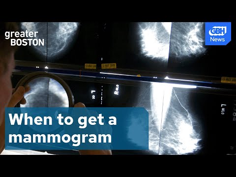 Why breast cancer screenings should start at 40 [Video]