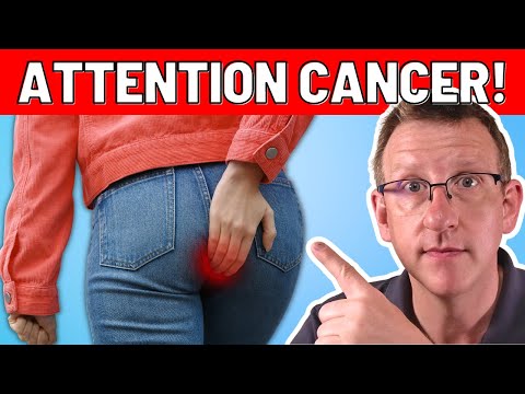 10 TOP early warning signs of CANCER (ACT NOW!) [Video]