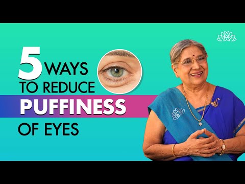 Home Remedies for Puffy Eyes I Treat puffy eyes naturally I Dr. Hansaji [Video]