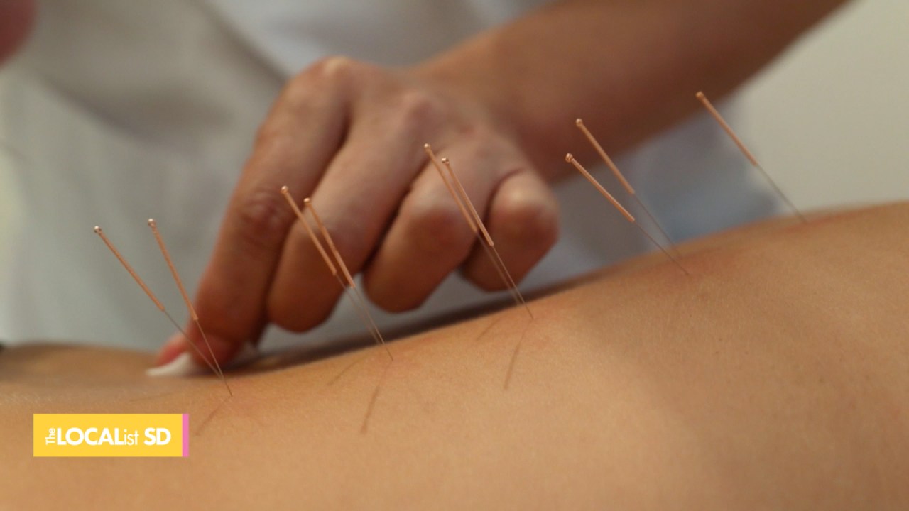 Mobile Acupuncture makes the service more accessible [Video]