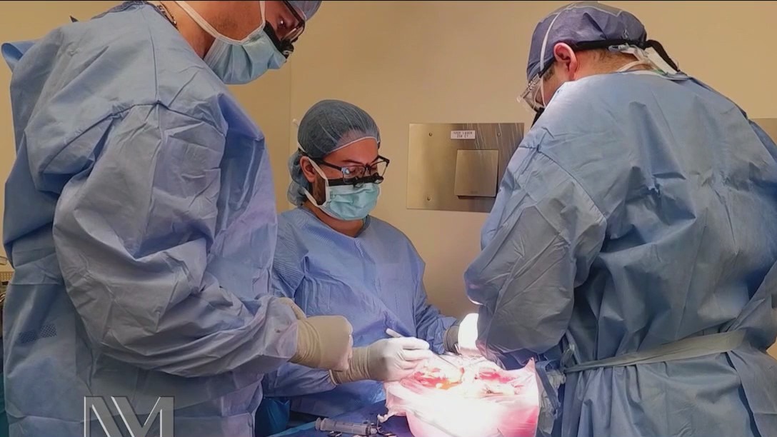 Northwestern Medicine marks major transplant milestone [Video]