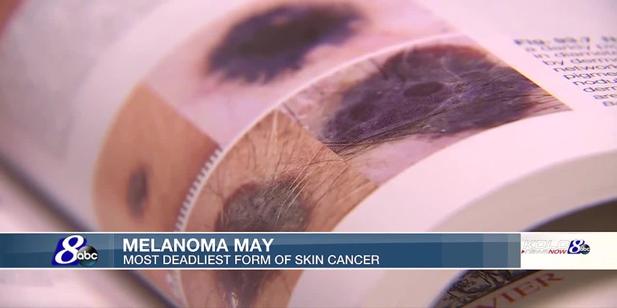 Melanoma Awareness During May [Video]