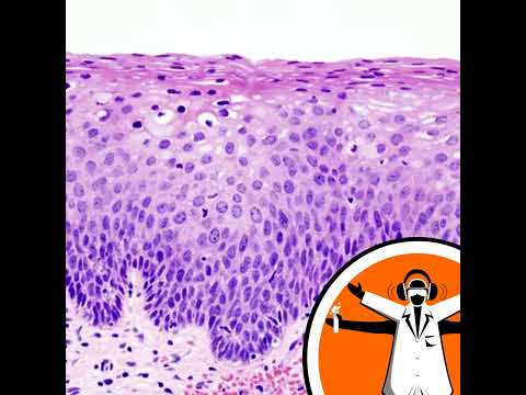 New test for cervical cancer [Video]