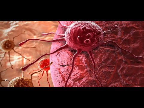 Understanding Cancer – Types, Symptoms, and Treatments (4 Minutes) [Video]
