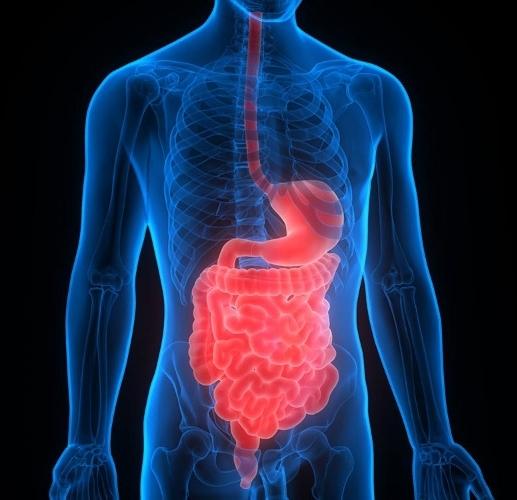 What is Inflammatory bowel disease? Why is it rising in India? [Video]