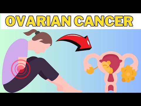 “Ovarian Cancer Awareness: Causes, Diagnosis, and Gynecologic Oncology Treatment” [Video]