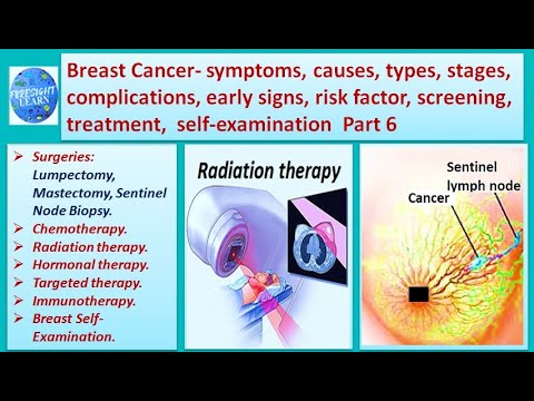 Breast Cancer  symptoms, causes, types, complications, stages,risk factor, treatment 6 [Video]