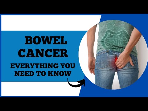 Bowel Cancer (Colon Cancer): Symptoms, Risk Factors,  Diagnosis and Treatment – Don’t Ignore This [Video]