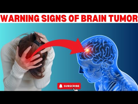 10 Subtle Warning Signs That You Have A Brain Tumor – Assessing Your Risk [Video]