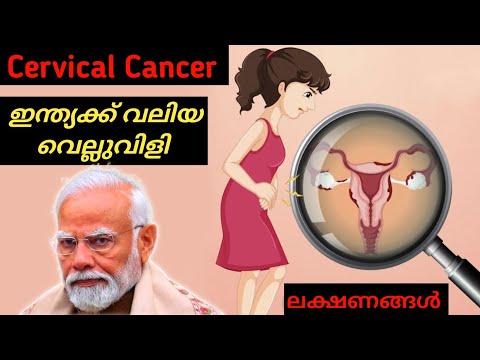 Cervical Screening Test | Cervical Cancer | HPV [Video]