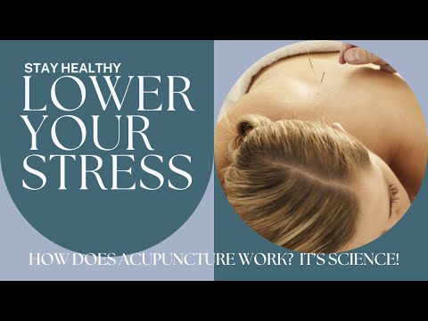 The Magic of Acupuncture Isn’t Magic, It’s Science  #stressrelief  [Video]