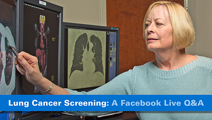 Free Lung Cancer Screening  Do You Need One? [Video]