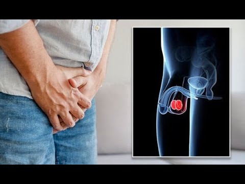 9 Signs To Know If You Got Testicular Cancer [Video]