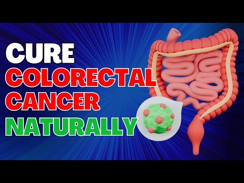 How To Cure Colon Cancer Naturally | Fit&Fab [Video]