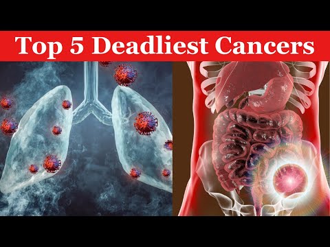 Exposing the Top 5 Worst Cancers [Video]