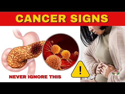 10 HIDDEN SIGNS OF CANCER THAT WOMEN SHOULD NOT IGNORE – Early Cancer Detection [Video]