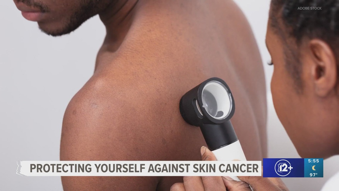 Valley church group hopes to raise awareness of the dangers skin cancer poses for everyone [Video]