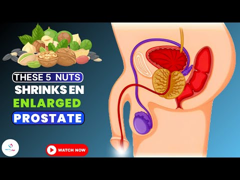 Prostate Enlargement Treatments: DO YOU KNOW These Nuts Can boost your Prostate Health? [Video]