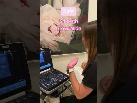 What are we Looking for During a Breast Ultrasound? [Video]