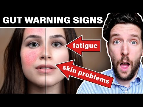 10 Warning Signs Your Gut Is Not Healthy! [Video]