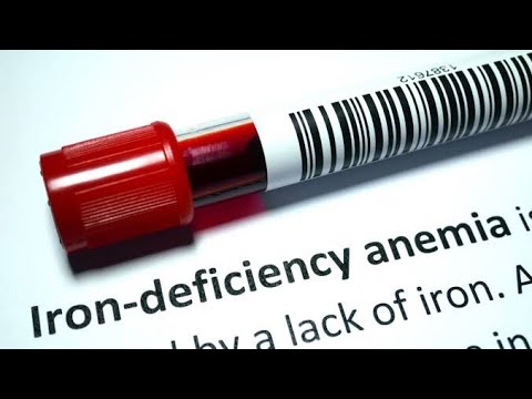 Tests and Observations  to Establish Possible causes of Iron deficiency Anaemia [Video]