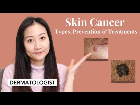 What you need to know about skin cancers | Dr. Jenny Liu [Video]