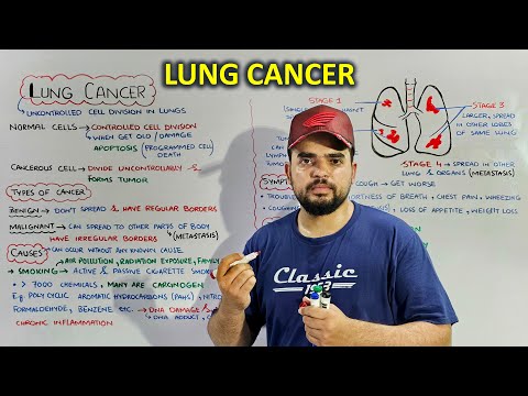 Lung Cancer: Stages of cancer, Causes, Symptoms and treatment [Video]