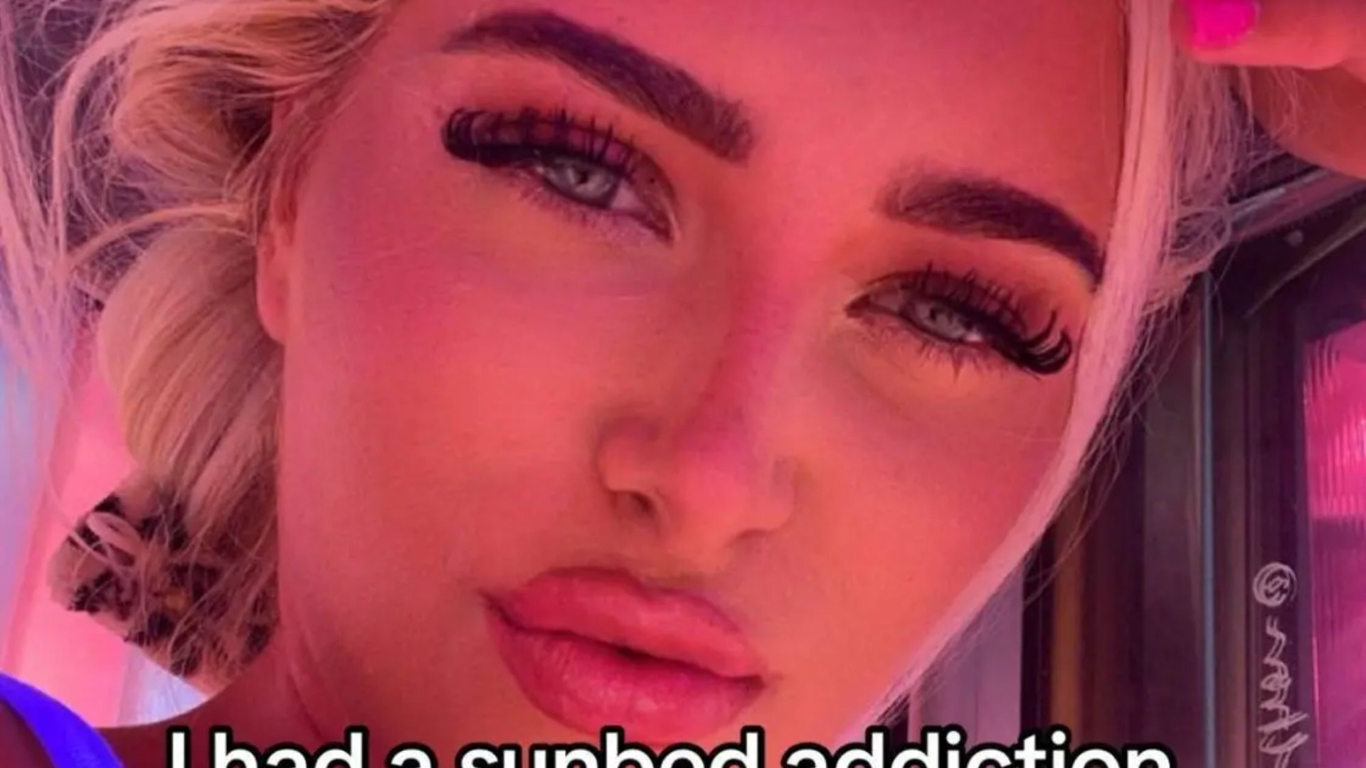 ‘Don’t underestimate the power of sunbeds’ influencer issues stark summer warning after addiction left her in A&E [Video]