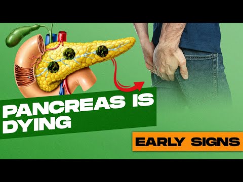 DON’T MISS THESE SIGNS: Early Detection of Pancreatic Disease [Video]
