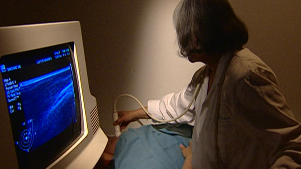 B.C.’s lack of breast ultrasound clinics could leave cancer undetected [Video]